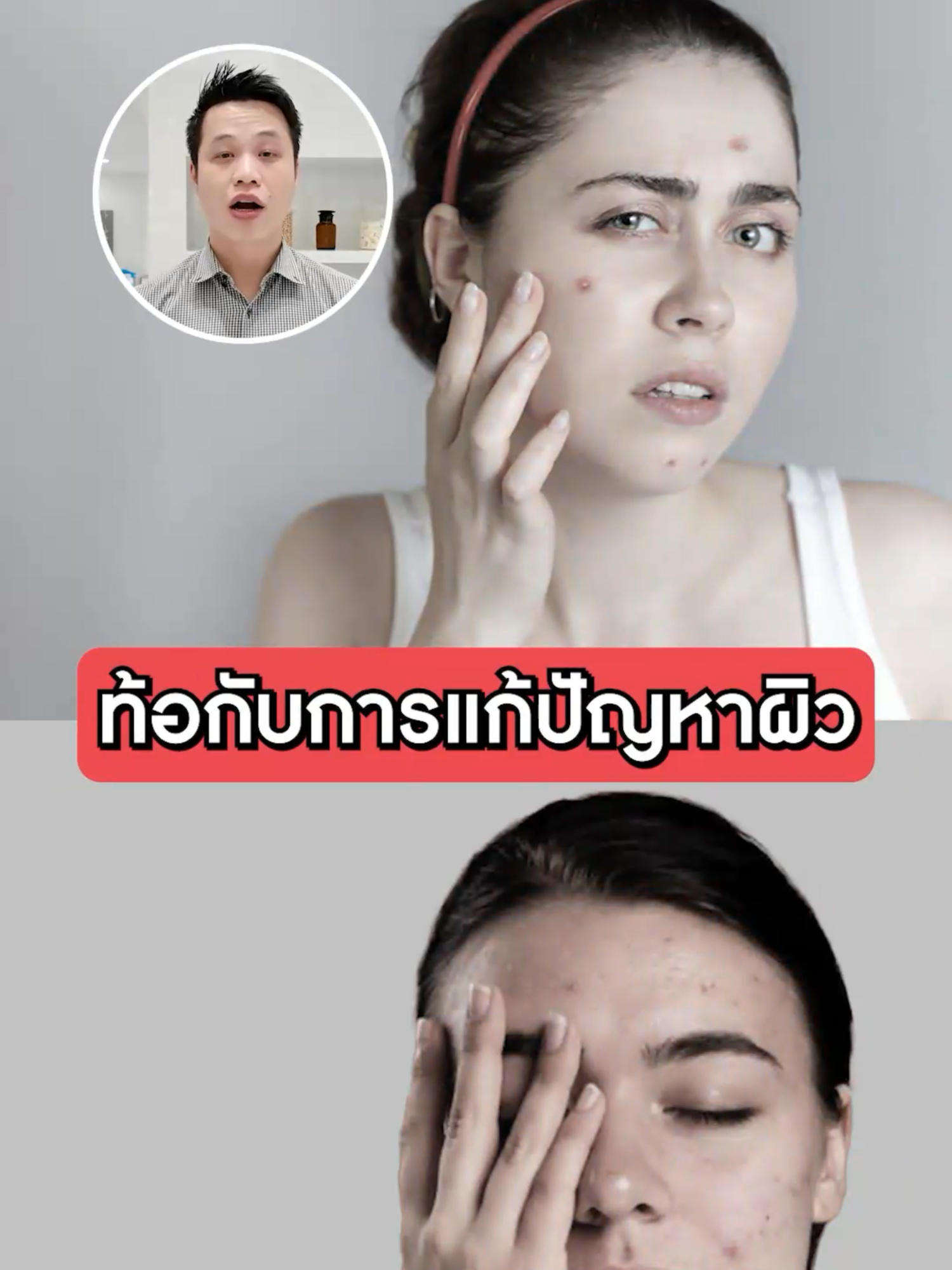 ใครท้อกับการแก้ปัญหาสิว มาลองดูคลิปนี้ครับ 👨🏻‍🔬❗ #สกินแคร์ #ดูแลผิว #ผิวหน้า #ของดีบอกต่อ #AMTSkincare #ผิวเราห้ามเดา #AMTSkinCheck #ตรวจผิว #fyp