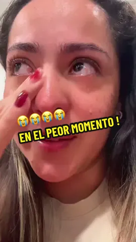 Si a ti te pasan estas cosas cuéntame cómo lo solucionas #mujeres #usa #problemas #inflamacion #viral 