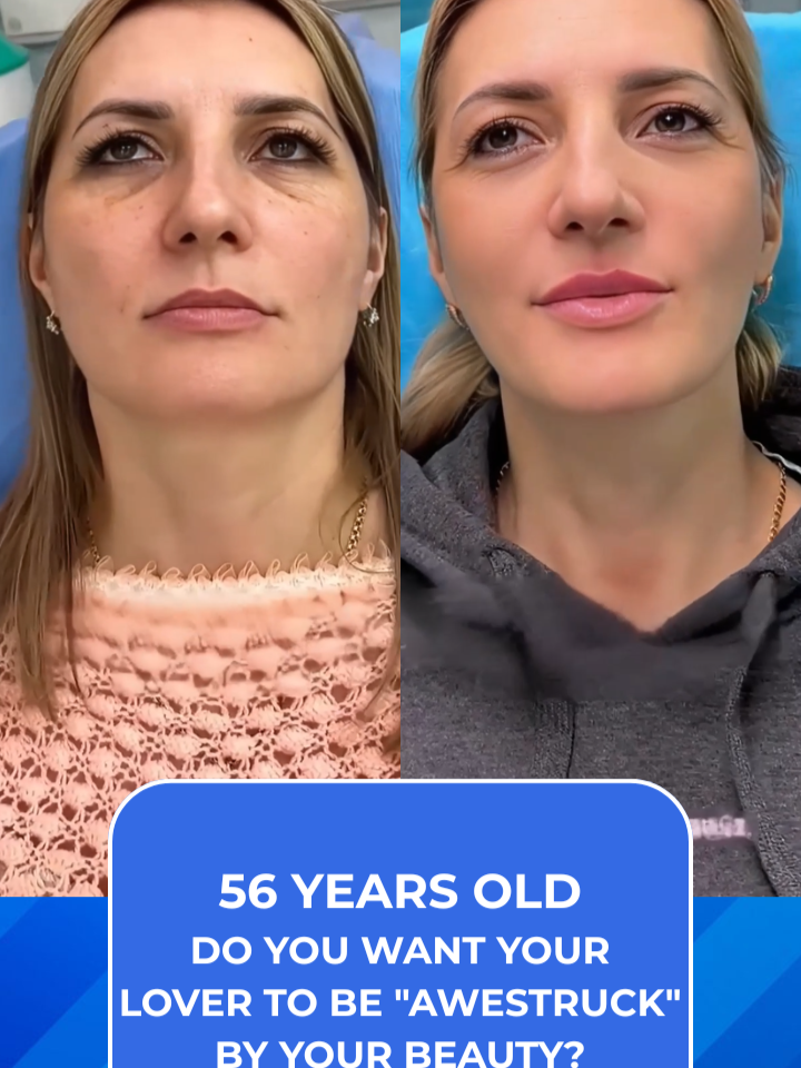#cosmeticsurgery #rhinoplasty #fullfacelift #necklift #facelift #eyelid #eyebrow #chin #liposuction #lips #abdominalliposuction #fullbodyliposuction #fatgrafting