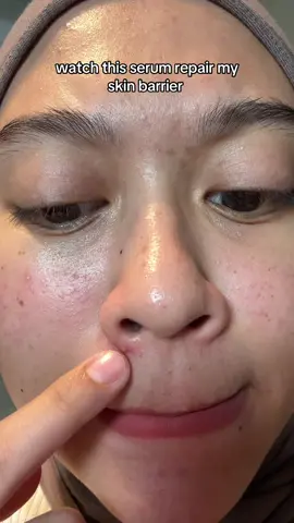 How i repair my skin barrier in 7 days ✨ #elformula #skinbarrier 
