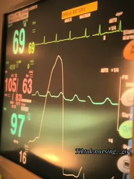 #hospital #hospitallife #hopital #nurse #operatingroom #nursing #nursingstudent ##ممرض #ممرضة #ممرضة❤️👩🏻‍⚕️ #تمريض #تمريض💉💊 #fupシ #fyp #trendingvideo #trendingsong #طب #doctor #doctorsoftiktok #Funk #Biscoitocut #FunkNoCapCut #Funk #Biscoitocut 