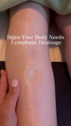 Ever pressed your leg and noticed a dent that sticks around? 🌀 That’s a classic sign of fluid retention — your body’s way of asking for help. Swelling can stem from all kinds of factors: 🍟 Poor diet 🛋️ Lack of movement 🌡️ Heat 🌀 Hormonal changes 💤 Or simply an overwhelmed lymphatic system The results? Bloating. Heaviness. Discomfort. Even leg pain. 💆‍♀️ Enter: Lymphatic Drainage ✔️ Promotes toxin elimination ✔️ Reduces puffiness and swelling ✔️ Boosts circulation ✔️ Delivers instant relief and a lighter, more energized body Just look at the before & afters — your body will thank you. ✨ Because taking care of yourself isn’t a luxury, it’s a necessity. 💖 #lymphaticdrainage #fluidretention #debloat #wellnessrituals #lightbody #manualdrainage #BeautyRoutine 