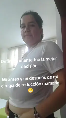 Gracias Dios por permitirme realizarme la cirugía de mis sueños 🙏🙏 ya se notan las diferencias 😁🥹#mamoplastia #reduccion #cirugiaplastica #dia9 #recuperación 