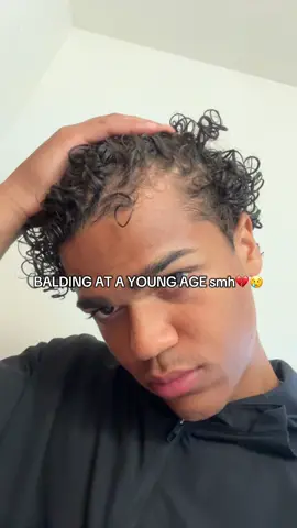 How I fixed my receding hairline and balding NATURALLY! #recedinghairline #hairthinning #balding #Dealsforyoudays #hairgrowth 