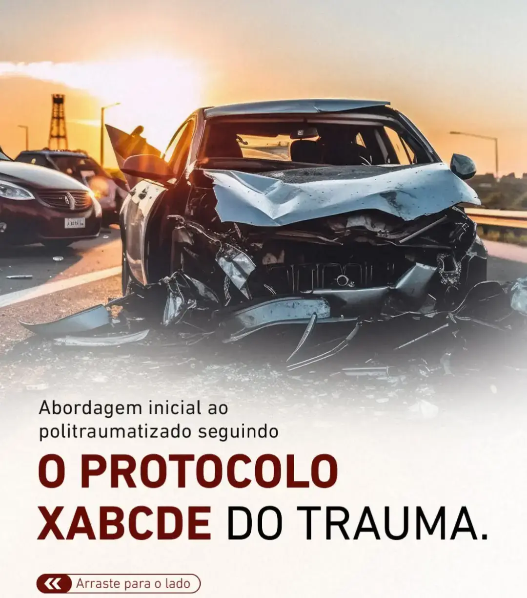 Xabcde do trauma.. esse protocolo é fundamental pra atender corretamente as vítimas de um trauma #desflopa  #creathorsearchinsight  #vaiprofycaramba 