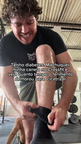 Sempre tive receio de me machucar por causa do diabetes. Mesmo com todos os cuidados, durante um treino acabei me ferindo na canela. Decidi registrar essa cicatrização pra mostrar, na prática, como o controle da glicose faz toda a diferença nesse processo. 🩹 Com atenção redobrada e acompanhamento, o ferimento já está quase 100% cicatrizado. Resolvi compartilhar essa evolução com vocês — porque sei que muita gente também tem dúvidas ou já passou por algo parecido. E por aí, como é o processo de cicatrização? Você sente que demora mais? Já teve alguma experiência parecida? Comenta aqui 👇 Quero trocar com vocês sobre isso. #DiabetesTipo1 #CicatrizaçãoEDiabetes #UmDiabético #CuidadosComAGlicose #ControleGlicêmico #VidaComDiabetes
