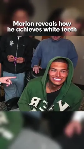 Marlon reveals his white teeth secret! #teeth #oralhealth #gurunanda 