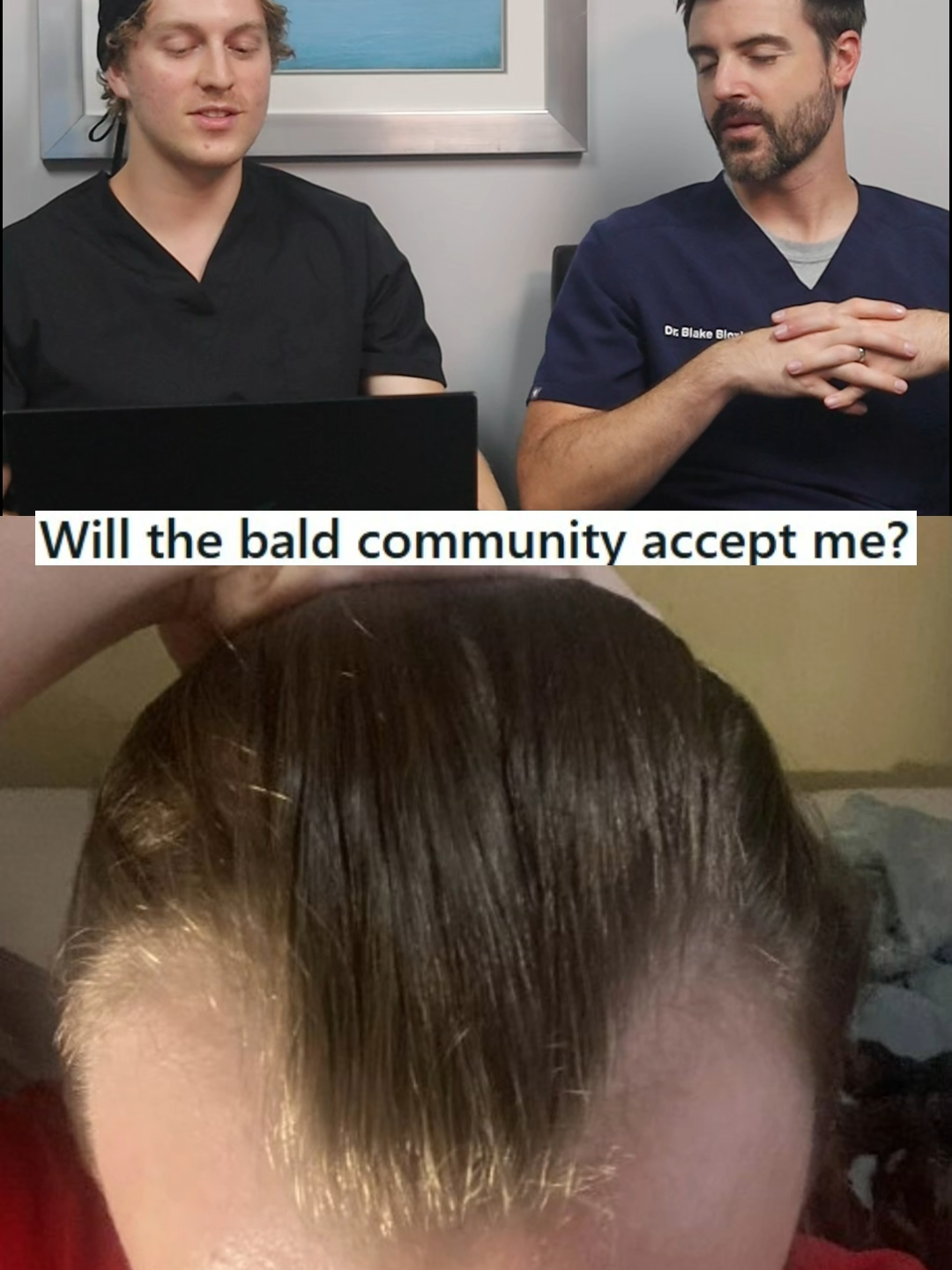 Youngest Hair Loss Patient Ever?