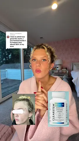 Replying to @craftedbykf How I cleared my hormonal acne without accutane! @CLEARSTEM Skincare USE CODE EMMAWILLMAN IF YOU WANT $$ OFF! #clearstem #clearstemskincare #hormonalacne #skincare #clearskin #hormonalacnejourney 