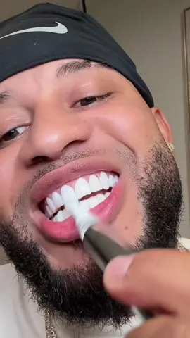 Look at my smile Now thanks to this teeth whitening pen from @MySmile_US 🦷🪥🤩 #teethwhitening #teethwhiteningpen #teethwhiteningtips #whitenteeth #mysmileteethwhitening #dealsforyoudays  