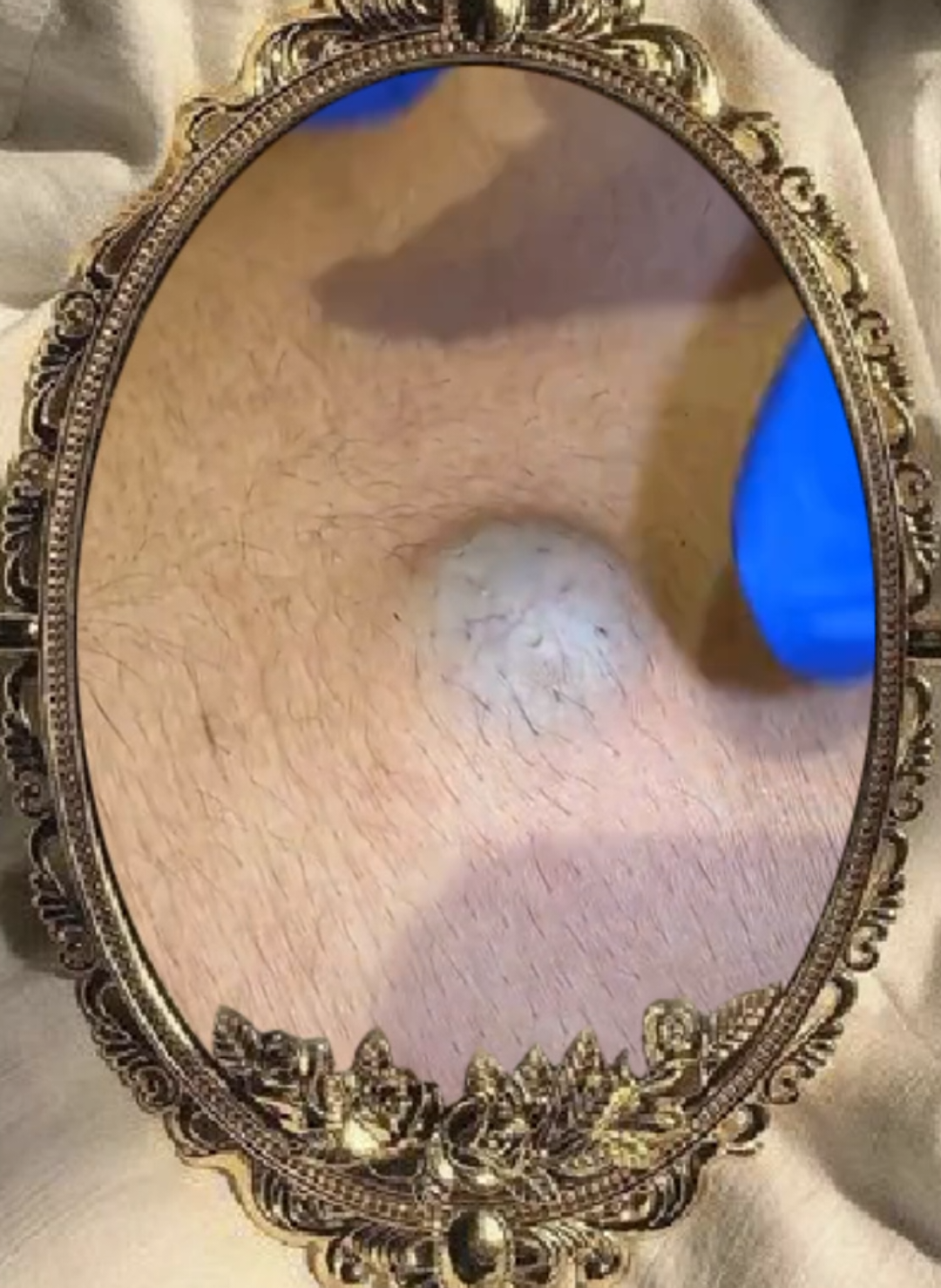 Giant pimple #pimples #blackheads #skincare #koreanskincare #koreanbeauty #anua #kbeauty #pimples #giant #giantpimple #removal #removals #removalasmr #fyp #asmr #asmrvideos #asmrsounds #asmreating #asmrtiktok 