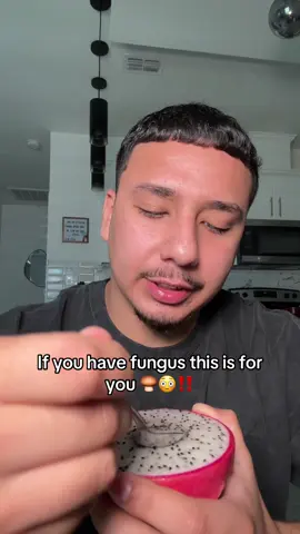 Please get rid of it you will feel much much better #fungi #toe #fungusnails #fungus 