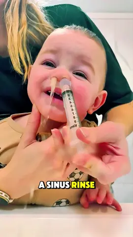 How Sinus RInse procedure works? (3D Animation) #sinusrinse #nasalirrigation #sinusrinseprocedure #medical3danimation #3dmedicalanimation #sinusrinsetips 