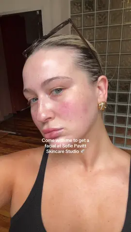 @Sofie Pavitt Face @sofiepavitt literally cleared my skin in 5 days 🥹 #sofiepavittface #sofiepavitt #mandelicacid #nyc #nycvlog #lifestylevlog #nycsummer #dayinmylife #nycfacial #acneproneskin #acneskincare #clearskin 