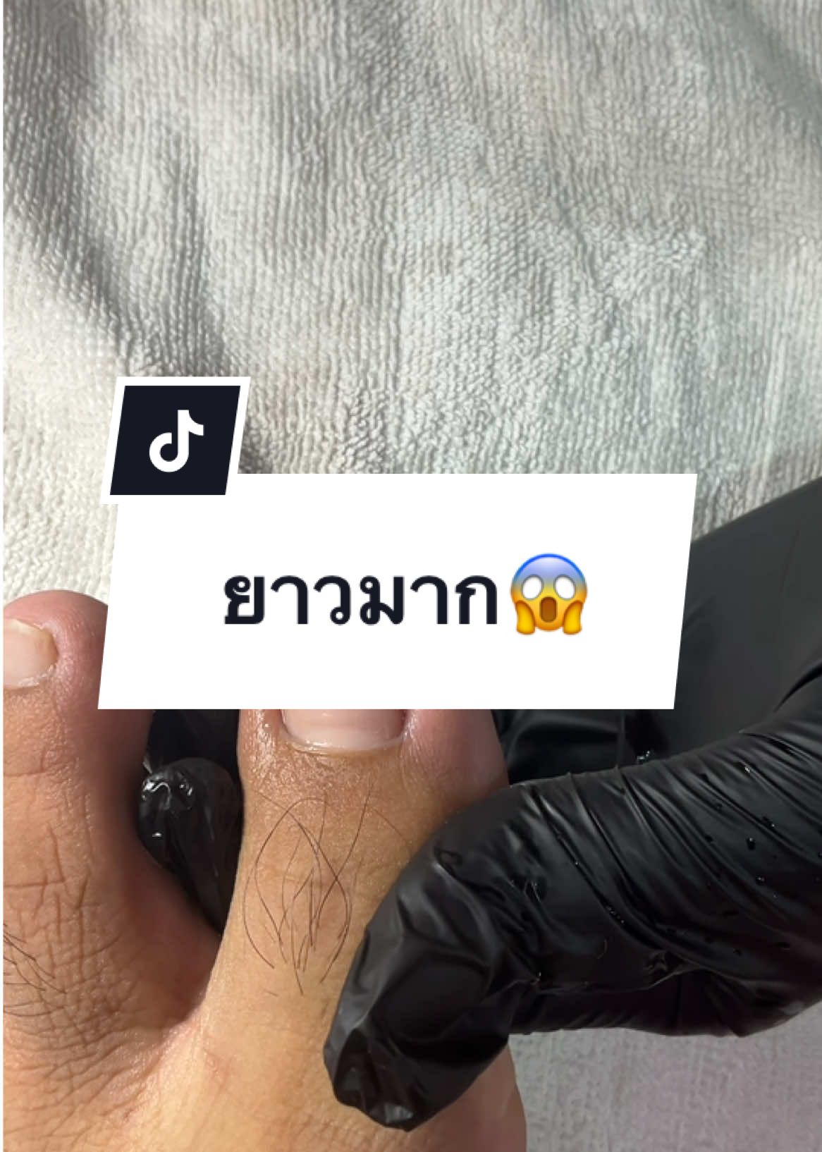 💓 #namthipnails #ตัดเล็บขบ #ตัดหนัง #ทำเล็บ #ร้านตัดเล็บขบ #ร้านตัดเล็บขบราม2 #ตัดเล็บ #เล็บขบ  #เล็บเชื้อรา Fb : namthipnails  Line : @namthipnails  นัมเบอร์วัน8 ตลาดม.ราม2  กทม  Map: namthipnails  https://goo.gl/maps/JmwpCKLfKwmhKGK96  ร้านเปิดทุกวัน เวลา12.00น-22.00น.