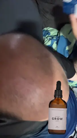 #hair #hairgrowth #bebodywise #hairserum #serum #rollon #haircare #baldness #guy #guys #boys #me #husband #dude #guyssupportingguys #dadssupportingdads #dadsoftiktok #dad #dads #tiktokshop #tiktokmademebuyit #tiktokshopcreatorpicks #creatorsearchinsights #fypシ #fypシ゚viral #fyp #foryou #foryoupage #foryourpage #dealsforyou #hotbuys #dealforyoudays #bald #balding #baldingsolution #baldingmen #besthairgrowthproducts2023 #ayahgrowthserumhaircaretips #besthairproductsforhairgrowth #hairgrowthproductsthatactuallywork #hairgrowthproducts💦🌱 #haircaremusthavesbesthairgrowth #besthairgrowthproducth #lowporosityhairproductreccomendations #goodhairproductsforhairgrowth 