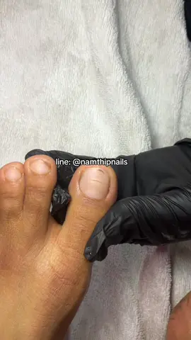 💓 #namthipnails #ตัดเล็บขบ #ตัดหนัง #ทำเล็บ #ร้านตัดเล็บขบ #ร้านตัดเล็บขบราม2 #ตัดเล็บ #เล็บขบ  #เล็บเชื้อรา Fb : namthipnails  Line : @namthipnails  นัมเบอร์วัน8 ตลาดม.ราม2  กทม  Map: namthipnails  https://goo.gl/maps/JmwpCKLfKwmhKGK96  ร้านเปิดทุกวัน เวลา12.00น-22.00น.