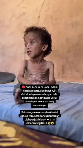 🛑 Anak kecil ini di Gaza, dalam keadaan rangka berbalut kulit akibat kelaparan melampau telah dinafikan hak paling asas untuk mendapat makanan yang mencukupi.  Kekurangan makanan berkhasiat ekoran kebuluran yang dilancarkan oleh penjajah Israel ke atas semenanjung Gaza.😭😭😭