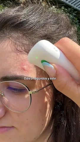 🦟 ¿Sabes cómo calmar una picadura… sin tener que rascarte hasta la locura? ⏱️ Dale 3 segundos… y este dispositivo aplica calor justo sobre la picadura, bloqueando la picazón casi al instante. Sin cremas, sin químicos, sin rascar. Perfecto para llevar en tu maleta este verano y olvidarte de los mosquitos. 🗣️ ¿Tú también eres imán para los mosquitos? Te leemos. #verano #mosquitos #salud #parati #atidamifarma