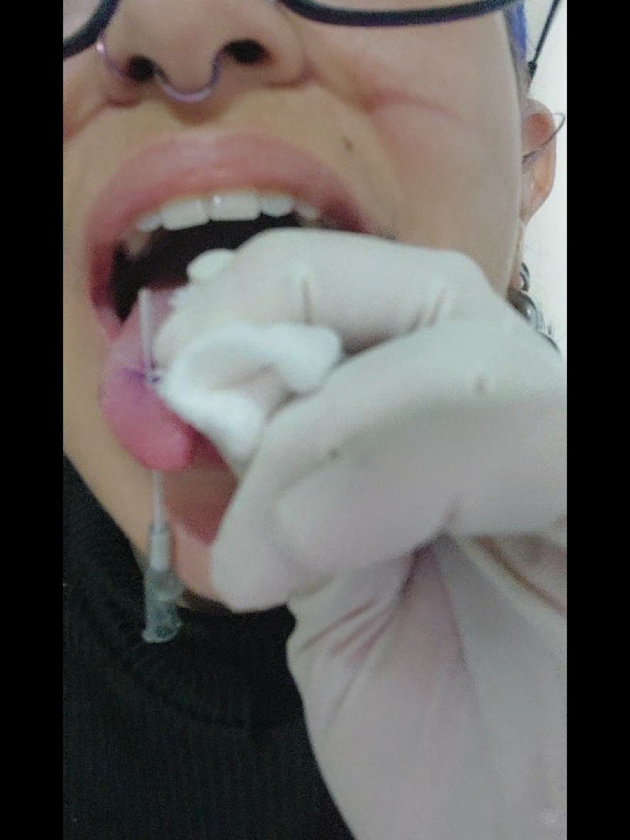 Que body piercer nunca se auto perfurou? 😅 Nunca mais faço isso! 🫠 #piercingbrasil #naoeumtutorial #piercer #doublepiercing #tongpiercing #bifurcada #linguabifurcada #piercinglingua #lingua #piercing #venompiercing #piercingvenom #venom 