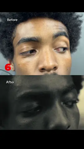 Close enough??👀 Before & after on N95 Paris🤞🏼 Directed by me Creative Directed by @yasminhero DOP @Ky  Cast  @Rubix Criminalz  @Jimmy Yudat  @johan.ts  & me