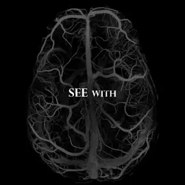 You don’t actually see with your eyes — your brain creates what you see. #BrainFacts #Neuroscience #VisionScience #MindBlown #SeeWithYourBrain #PsychologyFacts #FunScience #PerceptionVsReality #BrainPower #HowTheBrainWorks #TikTokEducation #SmartTok