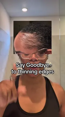 Thinning edges? Roll it back with Bodywise ! Their advanced hair serum@Targets weak spots with powerful actives for fuller, stronger hair — right where you need it the most 😉 #hairserum #thinningedges #edges #hairgrowthserum #hairoilforhairgrowth  