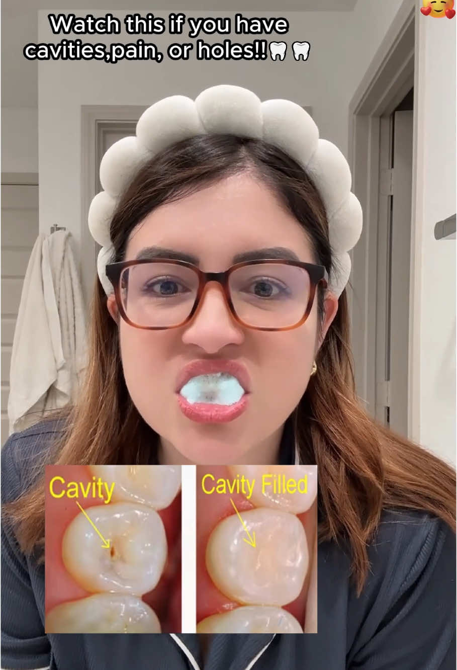 If you have tooth decay, abandon those traditional toothpastes—they won't help you. Try these toothpaste tablets; they can help repair your teeth. #teethwhitening#toothpastetablets #teeth #Cavity #Freshmile Whiten Toothpaste tablets#Dealsforyoudays