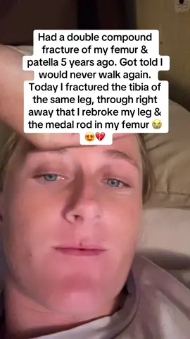 At this point should just be a bionic leg 💀🥹 #fyp #brokenleg 