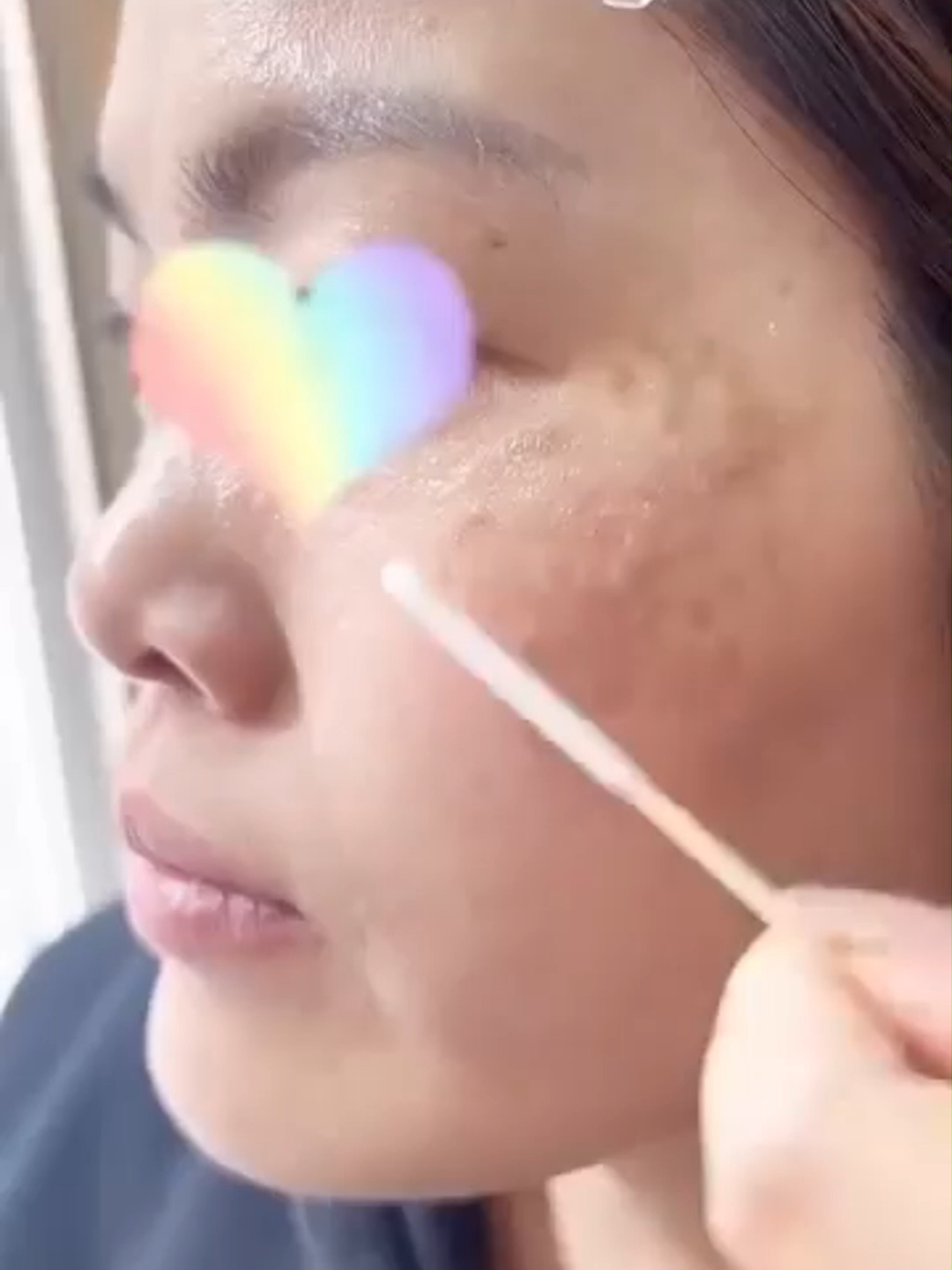Recommended by Dr. Joey!Targets dark spots, sun spots, and pigmentation — safely at home.