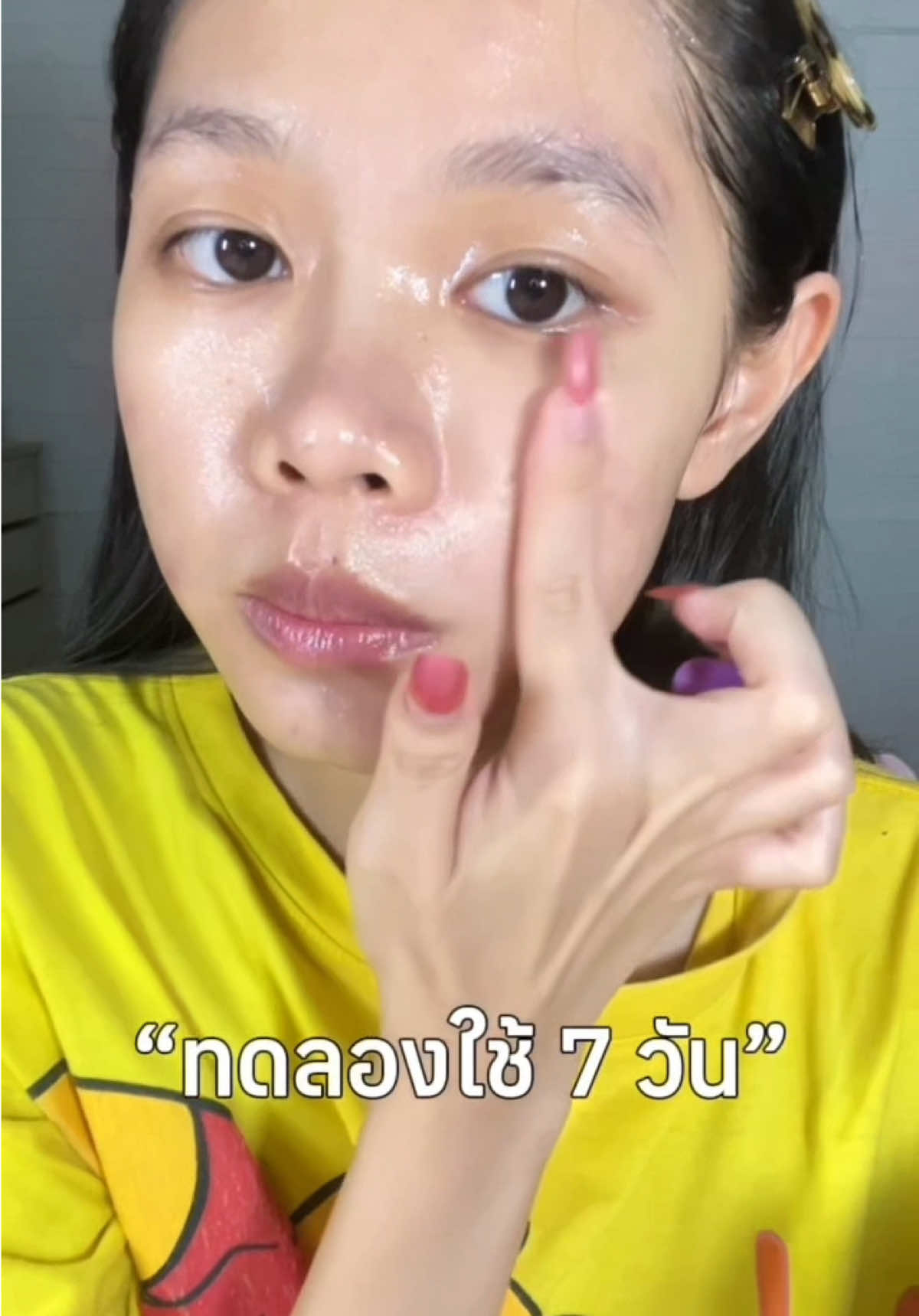 รอยสิวหายไวแบบดีเกินคาด!🧏🏻‍♀️ @ddee.official  #เจลรอยสิว #DDee #รอยสิว #รีวิวDDee #รอยดำ #รอยแดง #หลุมสิว #เจลน้องม่วง #รีวิวบิวตี้ 