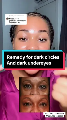 Replying to @yallmeetprincesss #fypシ゚viral #foryou #smallbusinessowner #skincarebusiness #darkcircles 