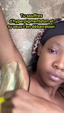 Un changement radical depuis que j’utilise ce produit contre les taches et mes boutons  #soinsvisage #skincare #viralvideotiktok #tiktoksenegal🇸🇳 