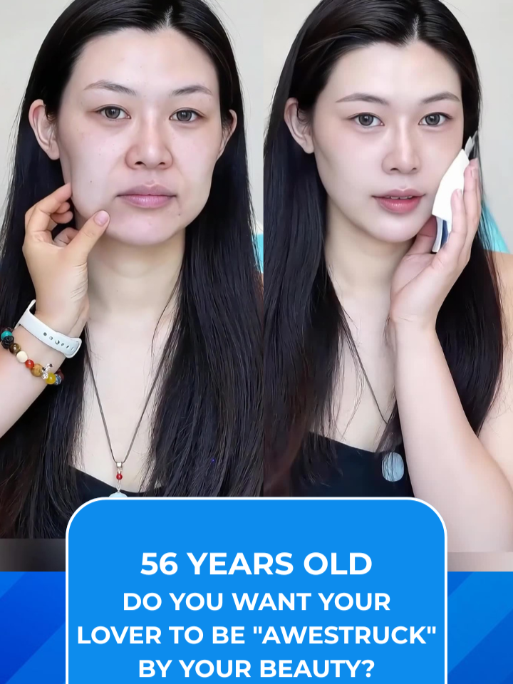 #cosmeticsurgery #fullfacelift #necklift #facelift #rhinoplasty #eyelid #eyebrow #liposuction #chin #abdominalliposuction #lips #fullbodyliposuction #fatgrafting #surgery #Facelift #fullface #indonesia