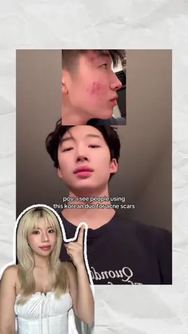 Sản phẩm này cần được viral hơn, tui có để link chính hãng ở dưới nhaaa🤩🤩 #AXISYVietnam #KBeauty #SkincareJourney #goclamdep #Darkspotserum #Tieumyy93 