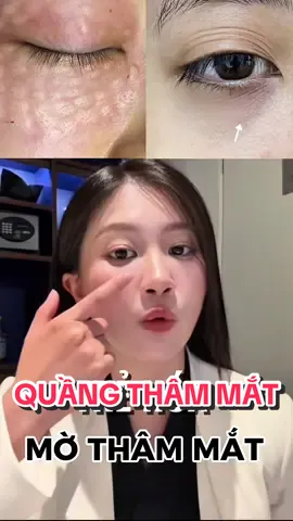 Xoá mờ quầng thâm mắt có thể nhìn trẻ hơn 10 tuổi với Rejuran và Redensity #bskhonghanhnguyen #tiktok #BeautyTok #rejuran 