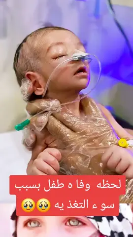 #غزة #اكسبلور  معاناة  أطفأ ل غ ز ه 
