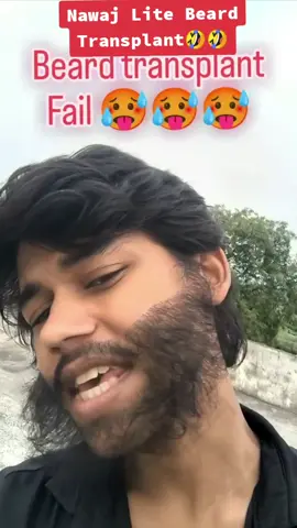 Nawaj Banchari Beard Transplat Gone Wrong 🤣🤣 