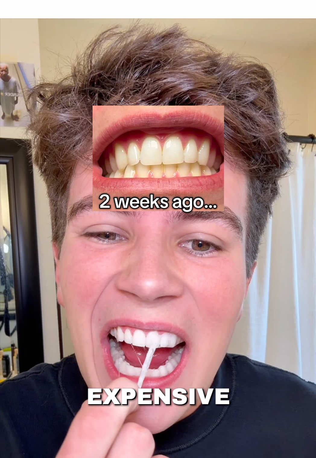 The only whitening strips that work frfr #teethwhitening 