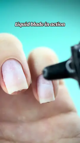 No cutting. No pain. Just ✨magic✨ This “liquid blade” melts away dead skin in seconds. Every nail prep deserves this. 🔹 Safe 🔹 Quick 🔹 Satisfying Would you try it? 👀👇 #liquidblade #cuticleremover #nailprep #nailtok #nailhack #satisfyingnails #nailtransformation #diynails #nailcaretips #fyp #foryoupage