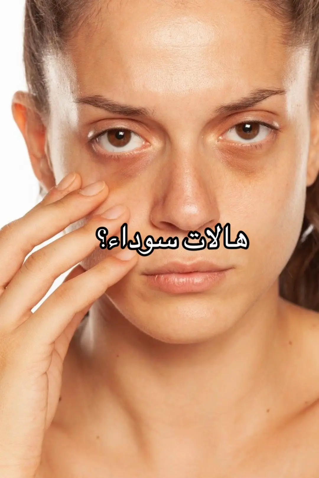 . . . . . #fyp #GlowUp #darkcircles #whitteeth #clearskin #eyes #lips #frizzyhair #skincare #fypageシ #glamour #girlstalk #foryoupage #دلع #بنات #حب #girls #ArabTikTok #feminineenergy #toxic #بنات_تيك_توك #viraltiktok #نصائح_تيك_توك #نصائح #Summer #viral #شعر #عناية #تونس🇹🇳_الجزائر🇩🇿_المغرب_مصر🇪🇬😍🌷كل #المغرب🇲🇦تونس🇹🇳الجزائر🇩🇿 #الامارات_العربية_المتحده🇦🇪 #الامارات🇦🇪 #قطر🇶🇦 #الاردن🇯🇴 #عراق #فرنسا🇨🇵_بلجيكا🇧🇪_المانيا🇩🇪_اسبانيا🇪🇸 #الشعب_الصيني_ماله_حل😂😂 #صيف_2025 #بشرة_صافية #هالات_سوداء #اسنان_بيضاء #شفايف_وردية #glowyskin 