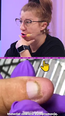 Co myślisz o nakładaniu stylizacji na paznokieć w takim stanie? Materiał zawiera autopromocję. #quloo #paznokcie #edytakruczak #nails #nail #nails💅 #naildesign #naildesigners #stylistka #stylistkapaznokci #uroda #beauty #tiktok #dc #dlaciebie #fy #fyp