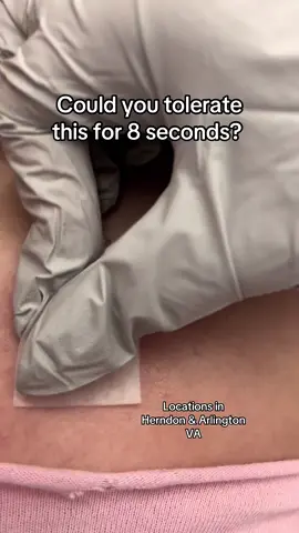 . Zapatat®️ is World’s Fastest Tattoo Removal 🔥. We remove tattoos in weeks, not years!!! 🔥 There’s no faster way to remove tattoos but with our ART technique. Book 📖 at www.Zapatat.net. Call 📱 703-248-0909 . . . . . #sterlingva#ashburnva#ashburnsalon#leesburgva#leesburgsalon#herndonva#herndon#chantillyva#dulles#dullesairport#centervilleva#manassasvirginia#manassasva#winchesterva#tattooremoval#tattooremovalspecialists#lasertattooremoval #fasttattooremoval#zapatat#tattooremoval #eyebrowcorrection #pmuremoval