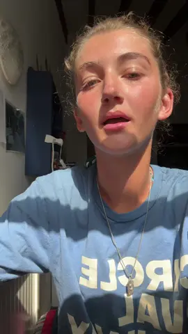 me trying to get my eyes in the sun 