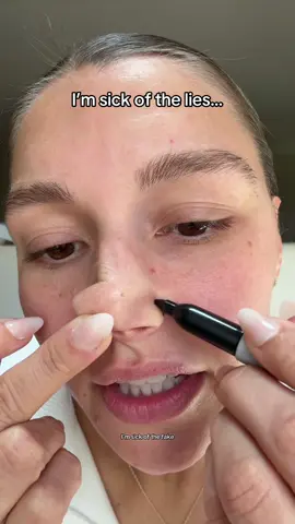 Replying to @www.NunTemple.com the sharpie came out for this test. This is why you need to buy this product from @drmelaxinglow - linked to this video! #drmelaxin #drmelaxinpeelshot #viralskincareproducts #tiktokshopcreatorpicks 