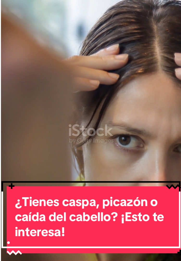 ¿Cansad@ de la caspa, picazón y caída del cabello? 🧠   Descubre cómo el jabón de turmalina puede ayudarte 🍃   Natural, efectivo y lo mejor: también cuida tu piel.   #caspa #jabonturmalina #caidadelcabello #cuidadocapilar #turmalina 