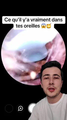 Découvre ce qu'il y'a vraiment dans tes oreilles avec ce truc😱🤢 #oreille #earwaxremoval #cire #cotontige 