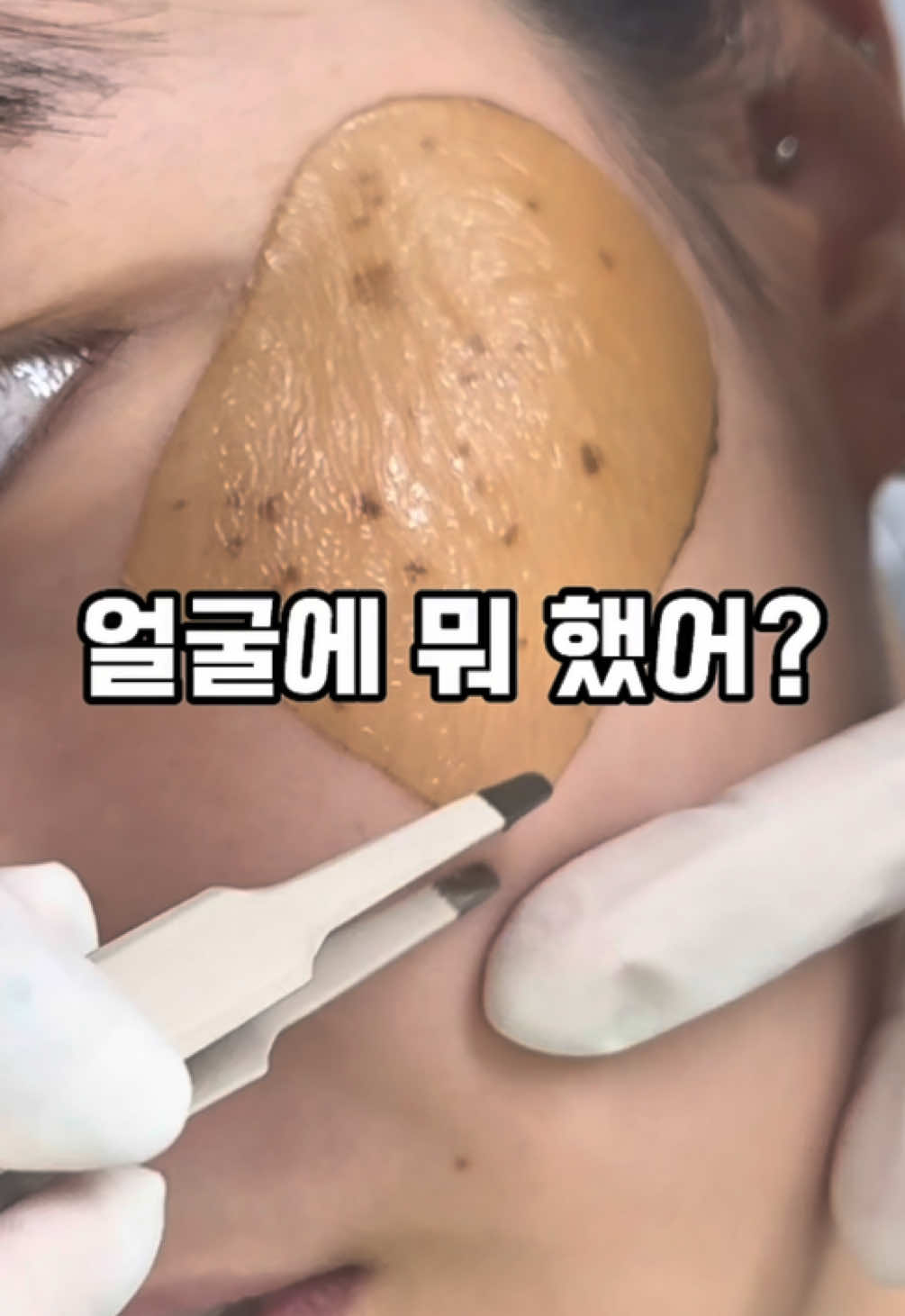 너 얼굴에 뭐 했어?? 잡티하나 없이 깨끗한 피부를 갖고싶다면  더 사이가 깊어지전에  기미 잡티와 작별인사 시켜드릴게요❤️ If you were worried about blemishes on your face Remove blemishes safely from the skin expert JJ_BIJOU 1 minute walk from Seoul Seongsu Station If you have any plans to visit Seongsu, Seoul, feel free to visit 顔の肌のシミが気になるなら お肌の専門家JJ_BIJOUで安全にシミだけ落としてみてください ソウル聖水駅徒歩1分 #くすみ除去 #そばかす除去 #잡티제거 #기미제거 #흑자제거 