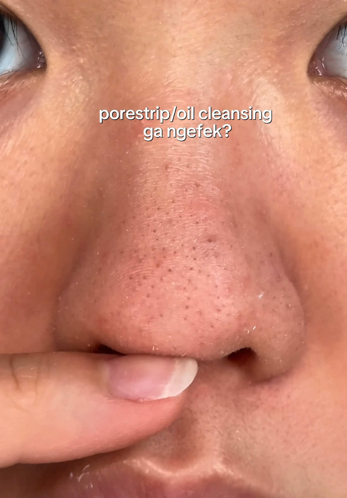 oil cleansing & porestrips are great for daily  pore care tapi aku ttp usahaiin facial 1/2 bulan sekali buat deep cleansing karena kulit aku combination🥲 btw ini aku PerfeClean Facial di @ERHA Ultimate Official! #erhafacial #facialtreatment #klinikerha #acneskin #acnefighter 