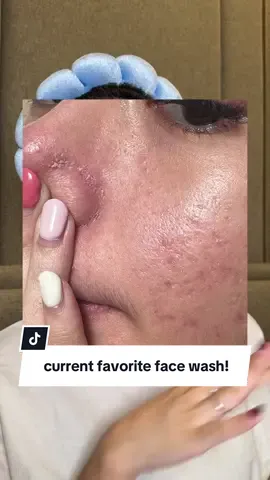 my current favorite facial wash!🫧 suuuper gentle, lembut banget dikulitku🥹✨ ada yang udah pakai jugaaa? @ERHA ACNEACT #GentleAcneFacialWash #GentleAcneHealing #AcneSkin #PembersihWajah 